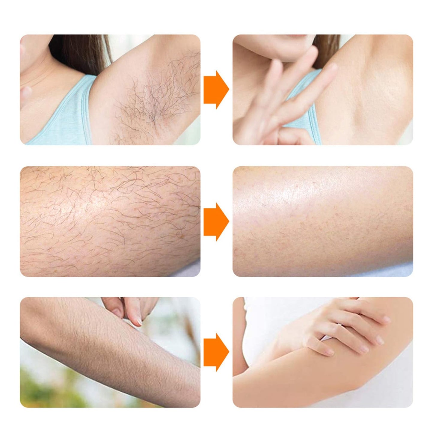 Electric Hair Removal Epilator for Women & Men, Rechargeable with Detachable Head, USB Chargeable Smooth Skin Epilator for Face Legs Arms Armpit Beauty and Personal Care Ymiko
