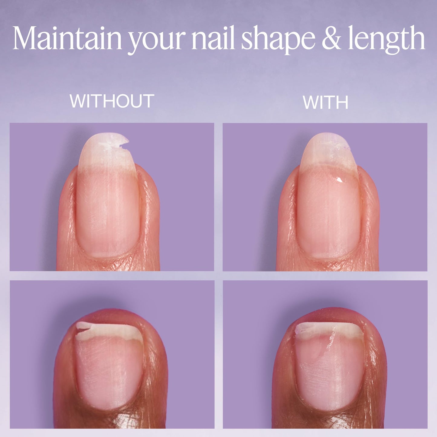 essie Break Fix Liquid Nail Patch, Nail Repair for Damaged Nails, 0.23 fl oz Beauty and Personal Care essie