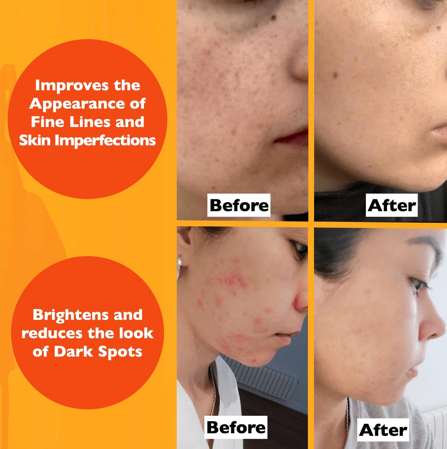 Vitamin C Serum For Face - Anti Aging Face Serum with Vitamin C, Hyaluronic Acid, Vitamin E. Brightening Formula. Improve Appearance of Dark Spots Beauty & Personal Care Florence