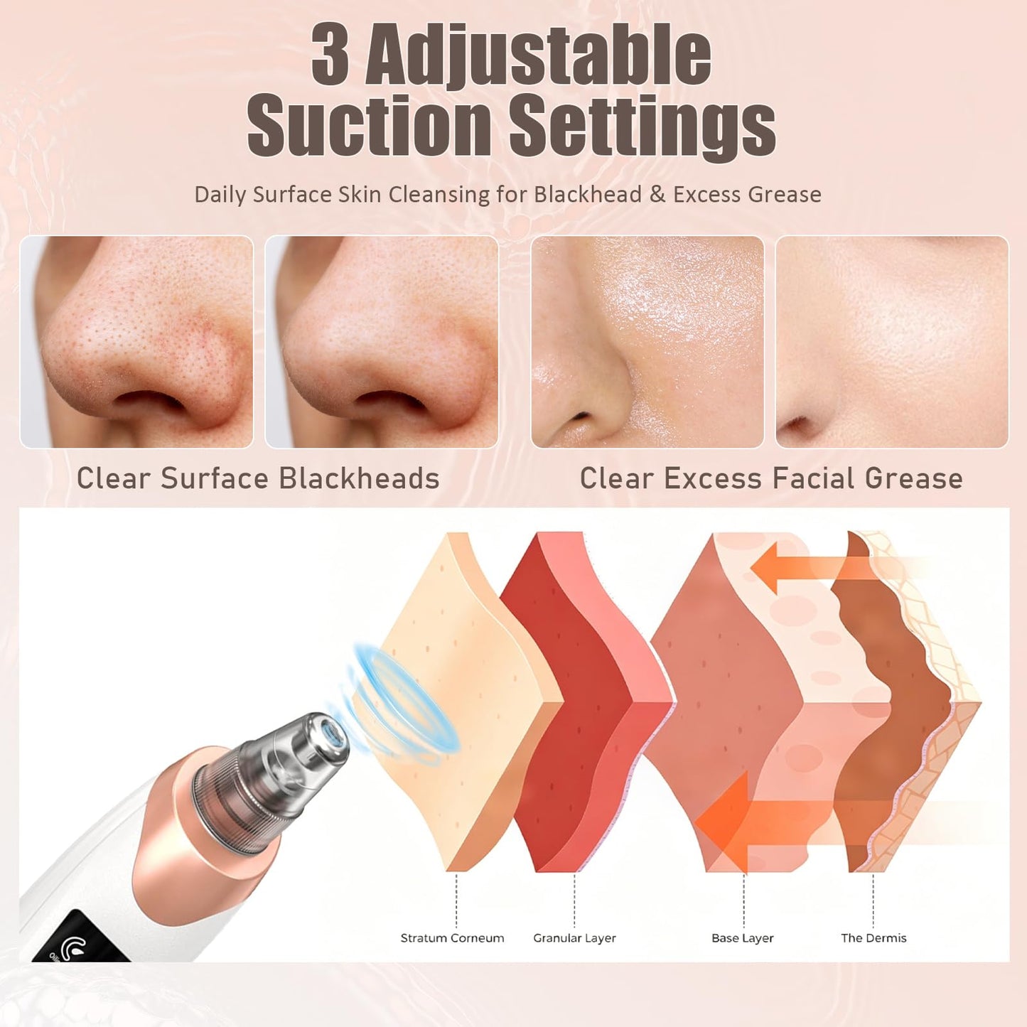 2026 Blackhead Remover Pore Vacuum,Facial Pore Cleaner-5 Suction Power,5 Probes,USB Rechargeable Blackhead Vacuum Kit Electric Pore Vacuum Tool Beauty and Personal Care Gackoko