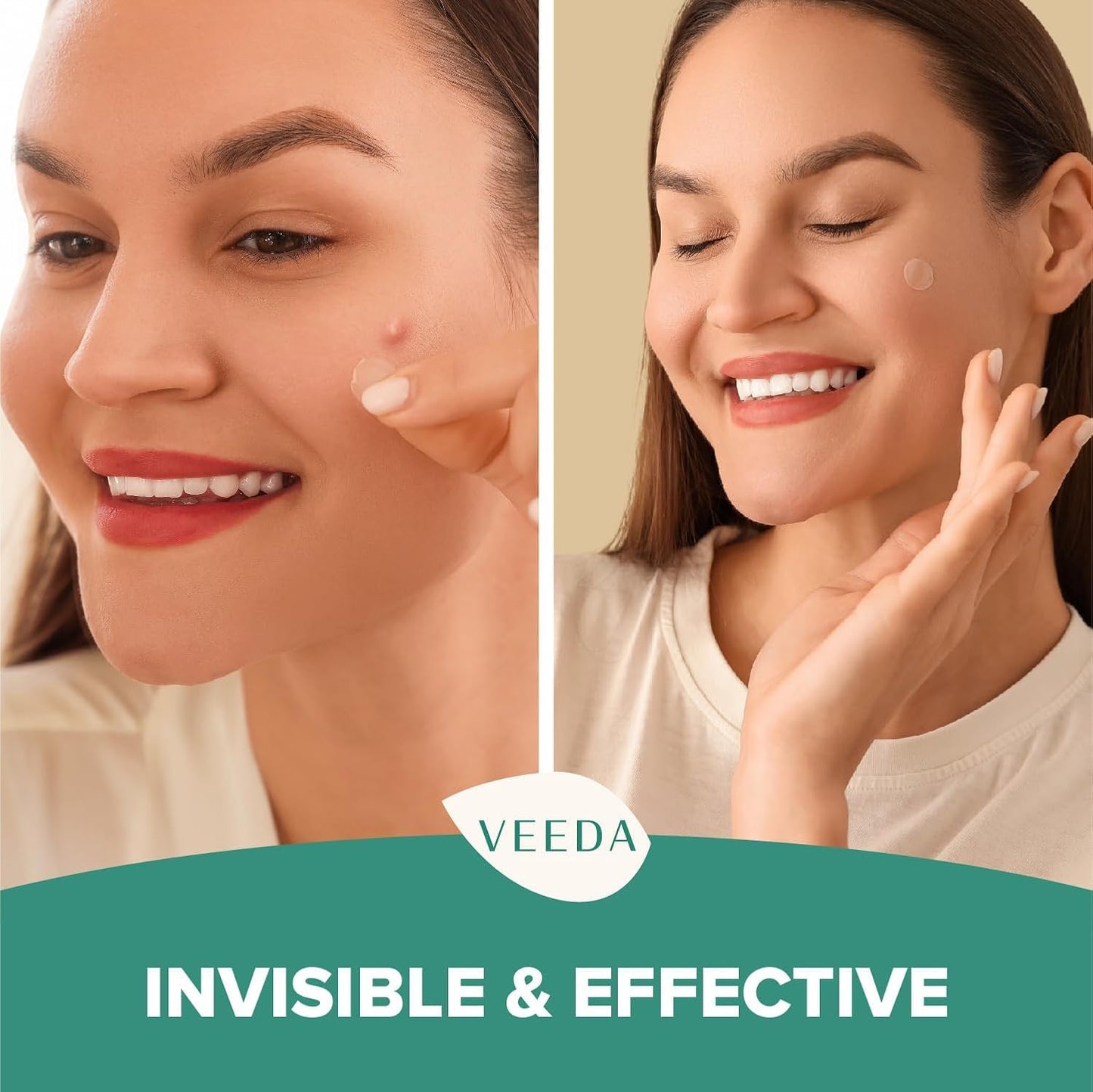 Veeda Glow Pimple Patches - Hydrocolloid Acne Stickers for Fast Healing, Invisible & Non-Irritating Zit Covers, Blemish Spot Treatment, 72 Count Beauty & Personal Care Veeda