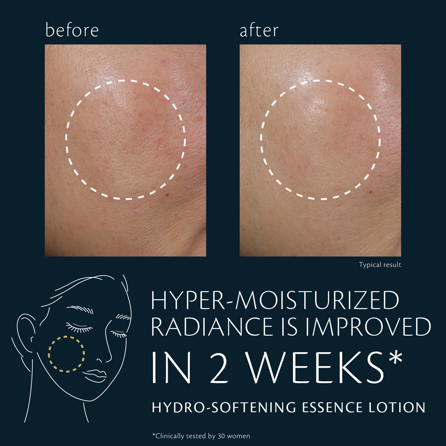 Hydro-Softening Essence Lotion (Refill) Beauty & Personal Care Clé de Peau Beauté