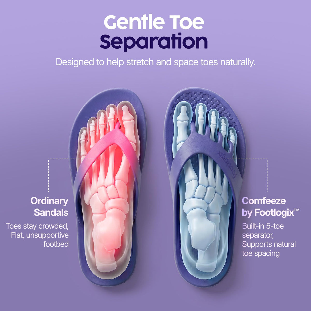 Comfeeze by Footlogix Recovery Sandals for Women - Toe Separator Pedicure Slippers with 5-Toe Spacing, Arch Support, Deep Heel Cup, Non-Slip Sole |