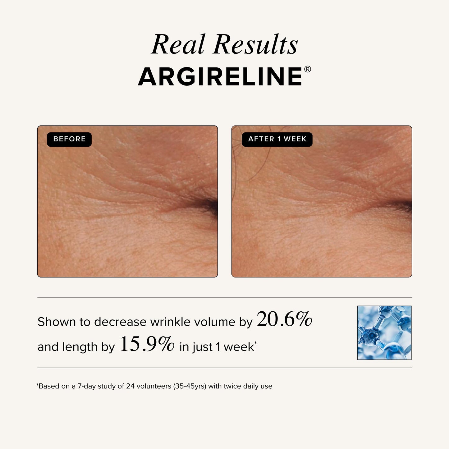 Asterwood Matrixyl 3000 + Argireline Serum with Hyaluronic Acid - Anti-Aging, Wrinkle Reducing, Collagen Boosting - Fragrance-Free - 2 Fl Oz Beauty & Personal Care Asterwood