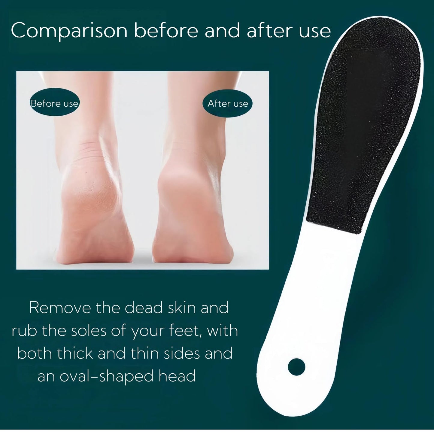 10 Pack Foot File, Professional Foot Callus Remover Sandpaper Pedicure Tools, Double Side Foot Scrubber, Sander for Dead Skin Foot Rasp Pedicure Beauty & Personal Care Agirlvct