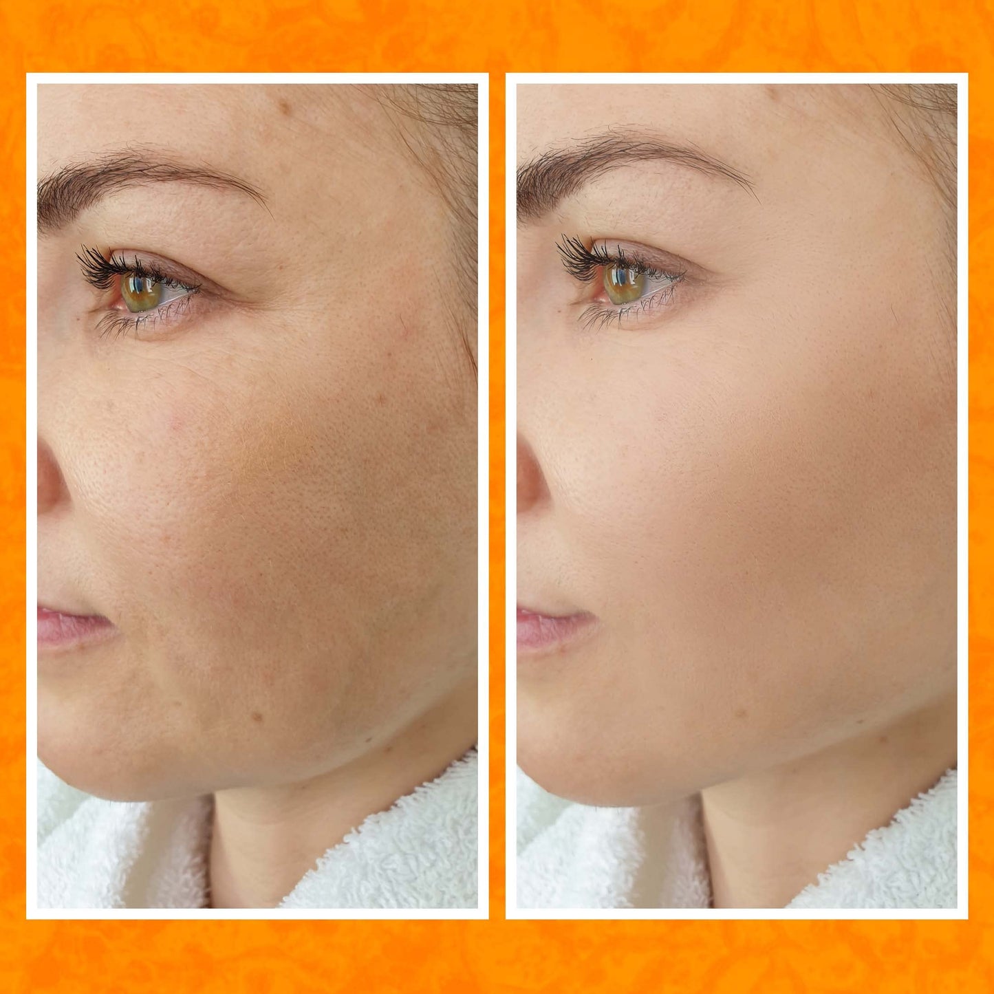 Bee and You Vitamin C Face Serum | Moisturizing Anti Aging, Reduce the Appearance of Dark Spots, Glow Up Skin Brightener with Propolis, Vitamin E Beauty & Personal Care BEE & YOU