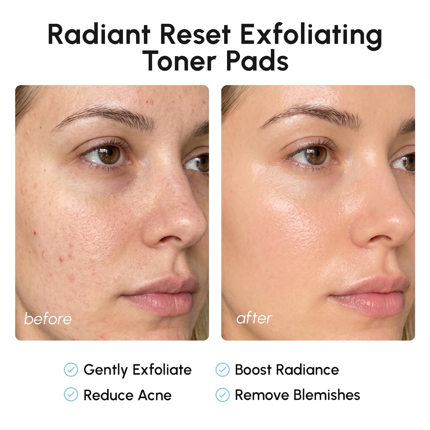 MAREE Glycolic Acid Pads - Toner Pads for Face Cleansing - Exfoliating Pad with Tea Tree Oil, Salicylic Acid & Vitamins E, B3, B5 - Facial Polishes Beauty and Personal Care MAREE