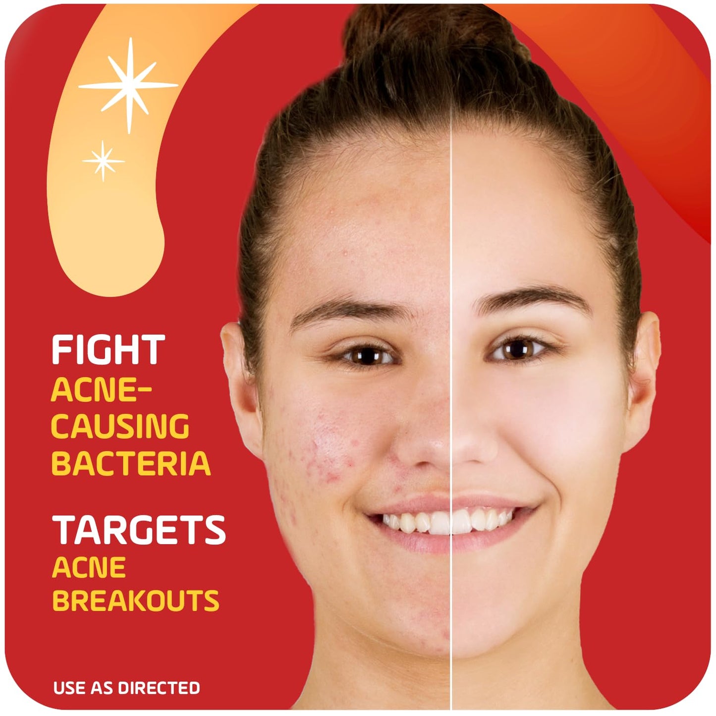 Asepxia 2% Salicylic Acid Acne Spot Treatment Cream | Drying Formula Targets Acne, Clears & Prevents Blemishes, Reduces Redness, Penetrates Pores Beauty & Personal Care Asepxia