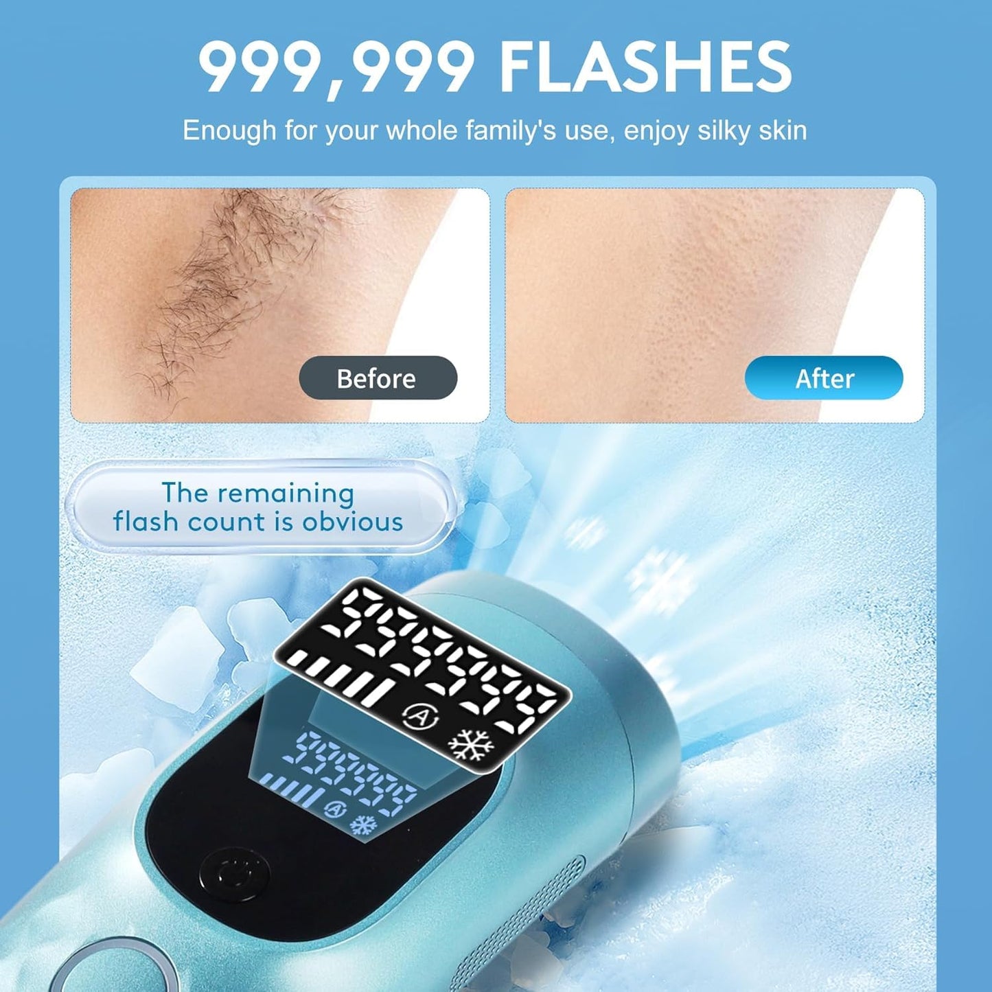 Laser Hair Removal for Women and Men with Shaver Goggles Ice Cooling Painless IPL Hair Removal Device for Body 5 Adjustable Modes 999,999 Flashes Beauty and Personal Care zeusword