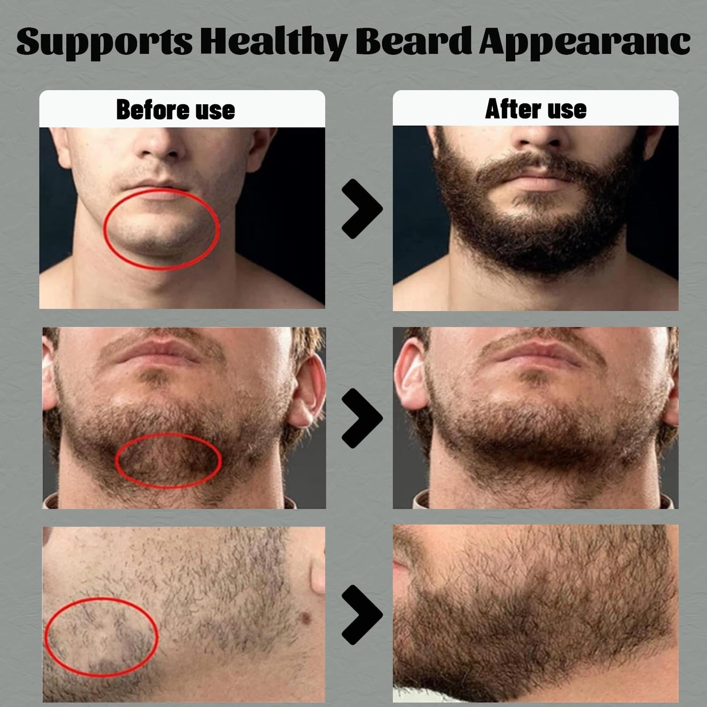Para Barba, Shea Moisture Beard Balm for Men, Crecimiento De Barba Para Hombre, Beard Growth Vitamins, Estimulante De Barba Ultra Potente, Strengthens Beauty and Personal Care apolo cosmetics
