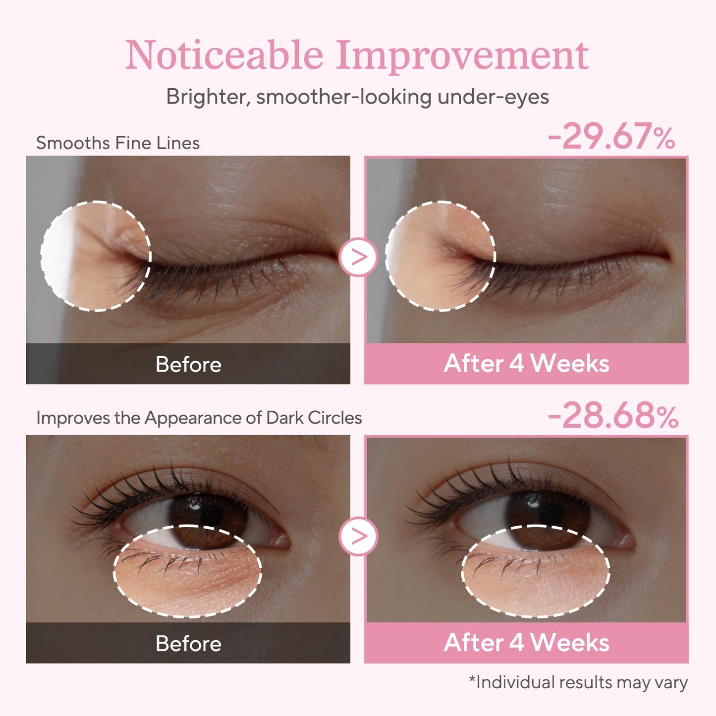 ALVESTRA Under Eye Cream with Salmon DNA PDRN & Pink Peptides Beauty & Personal Care ALVESTRA