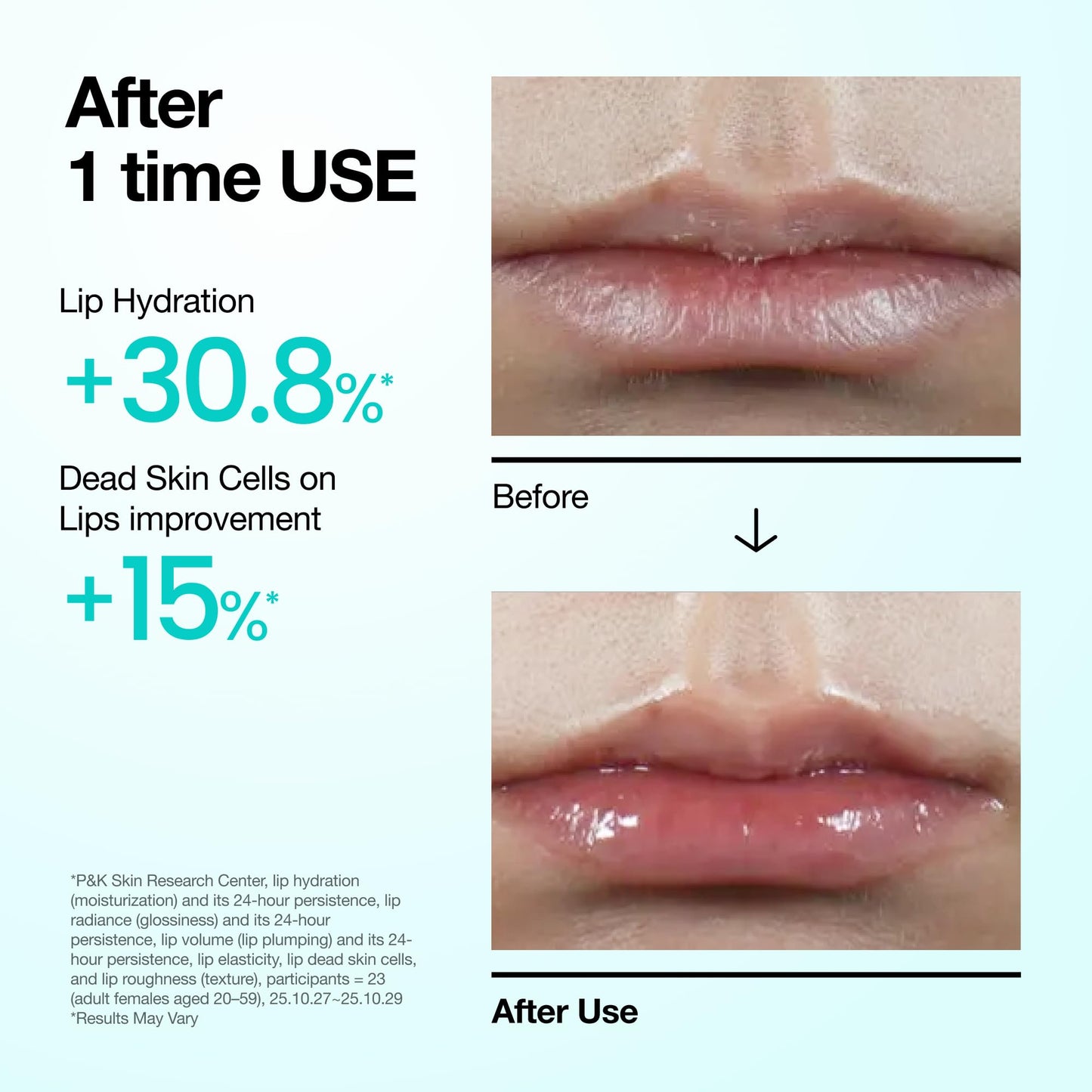 Anua PDRN Lip Serum, Long-lasting Hydration for Dry, Cracked Lips, Non-Sticky Moisturizing Lip Care with Salmon DNA, Hyaluronic Acid & Collagen Beauty and Personal Care ANUA