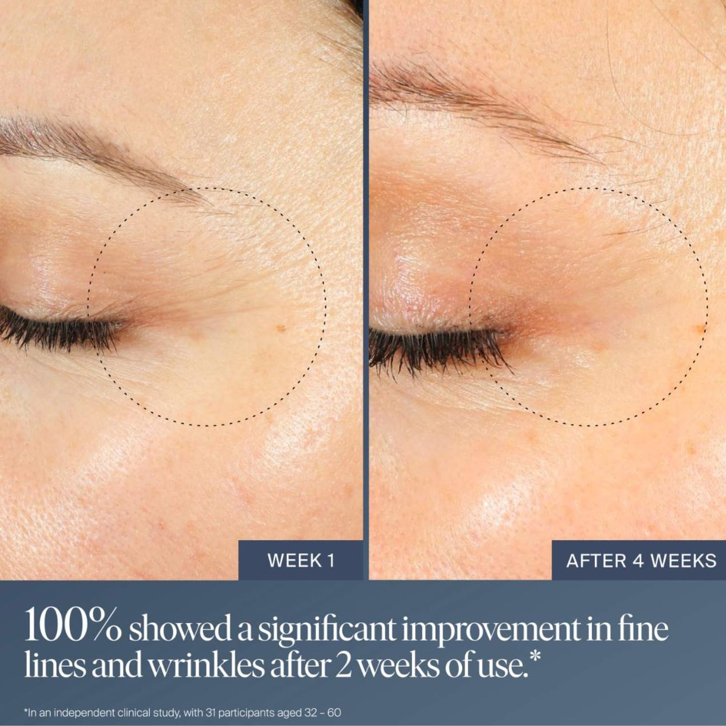 Summer Fridays Jet Lag Overnight Eye Serum - Nourishing Undereye Treatment for Dark Circles - Helps to Hydrate, Smooth, Firm & Depuff - Enriched Beauty & Personal Care Summer Fridays