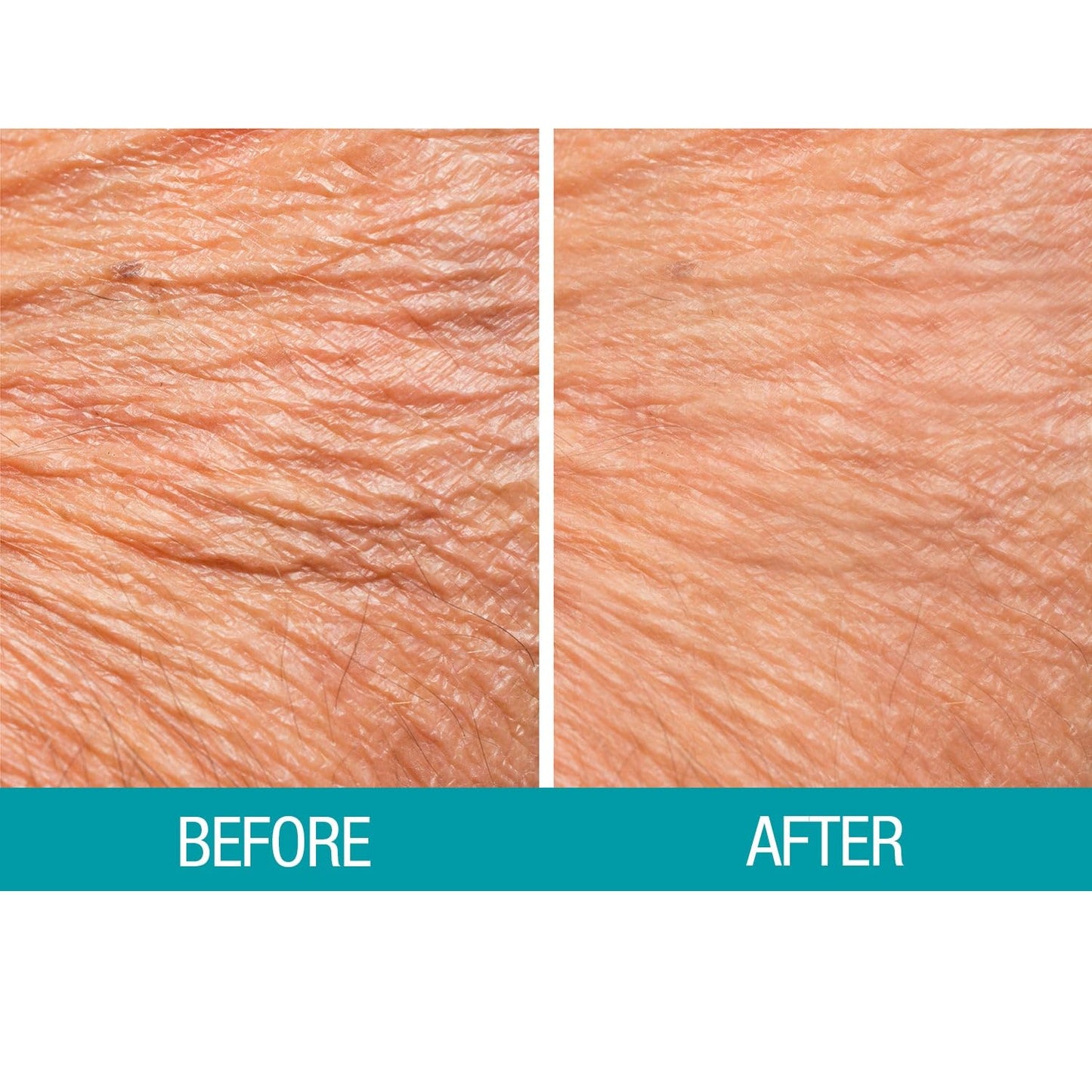 Dermactin Crepe Skin Firming Cream 2.5 oz. Beauty & Personal Care Dermactin