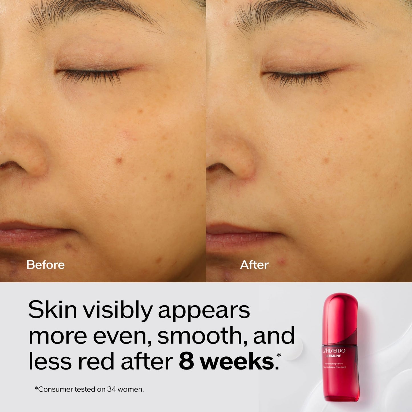 Shiseido Ultimune Power Infusing Serum - 1 oz - Breakthrough Lightweight Face Serum - Boosts Radiance & Improves Visible Signs of Aging - All Skin Beauty & Personal Care Shiseido