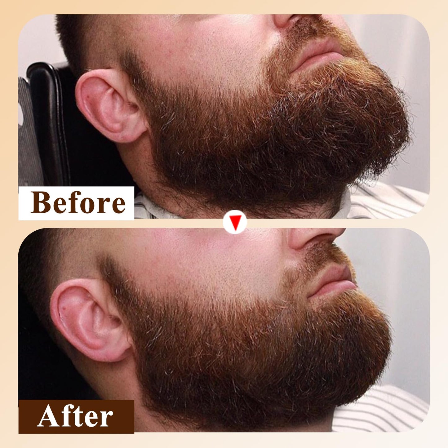 Varolan Beard Oil for Men,Natural Mens Beard Oil Capsules,Naturally Derived Conditioner with Argan Oil,Grapeseed Oil,Jojoba Oil and Vitamin E Beauty and Personal Care Varolan