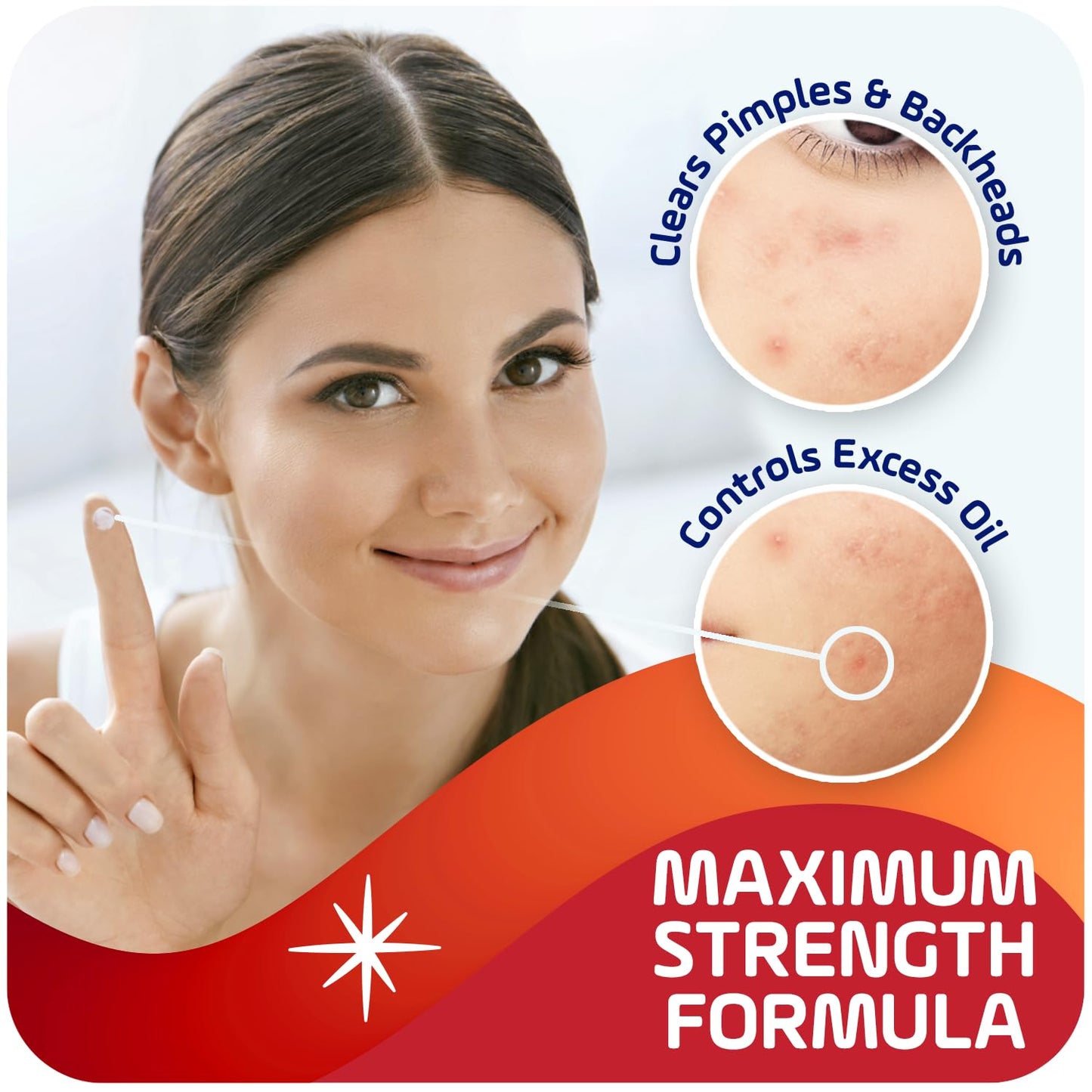 Asepxia 2% Salicylic Acid Acne Spot Treatment Cream | Drying Formula Targets Acne, Clears & Prevents Blemishes, Reduces Redness, Penetrates Pores Beauty & Personal Care Asepxia
