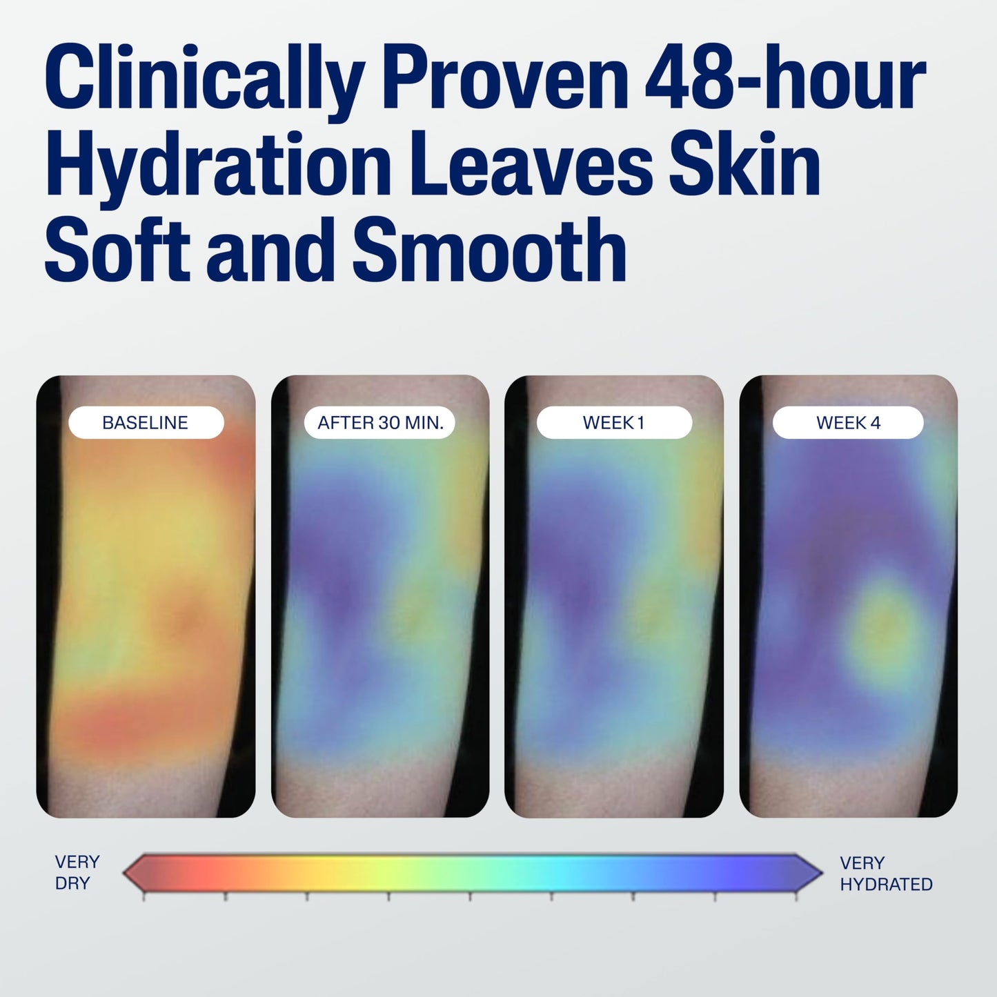 Cetaphil Face & Body Moisturizer, Hydrating Moisturizing Lotion for All Skin Types, Suitable for Sensitive Skin, NEW 20 oz, Fragrance Free Beauty & Personal Care Cetaphil