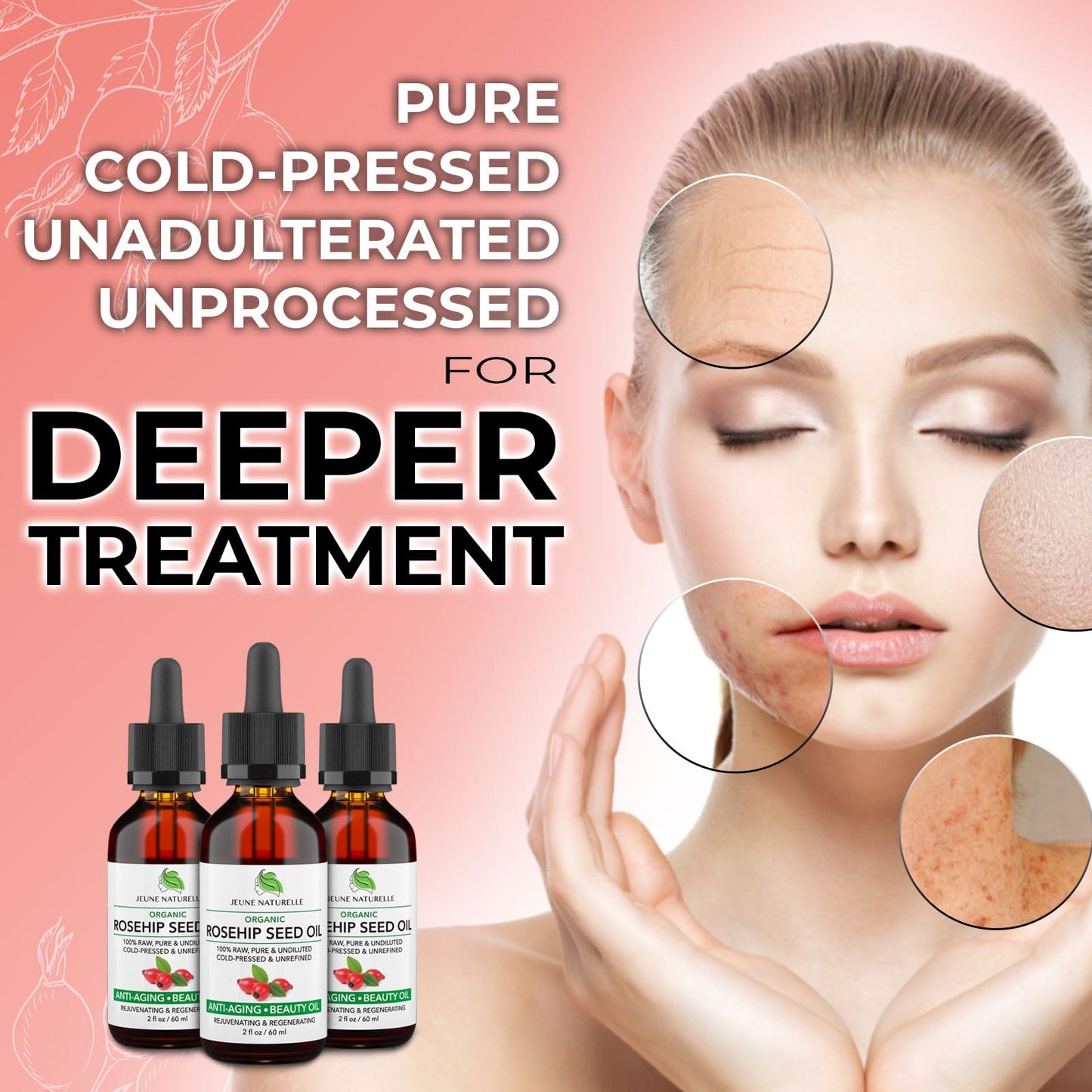 Rosehip Oil - Pure, Virgin, Cold Pressed - From Whole Berries (Pulp & Seeds), Natural Deep Orange Hue for Intensive Skin Repair - Undiluted Organic Beauty & Personal Care Jeune Naturelle