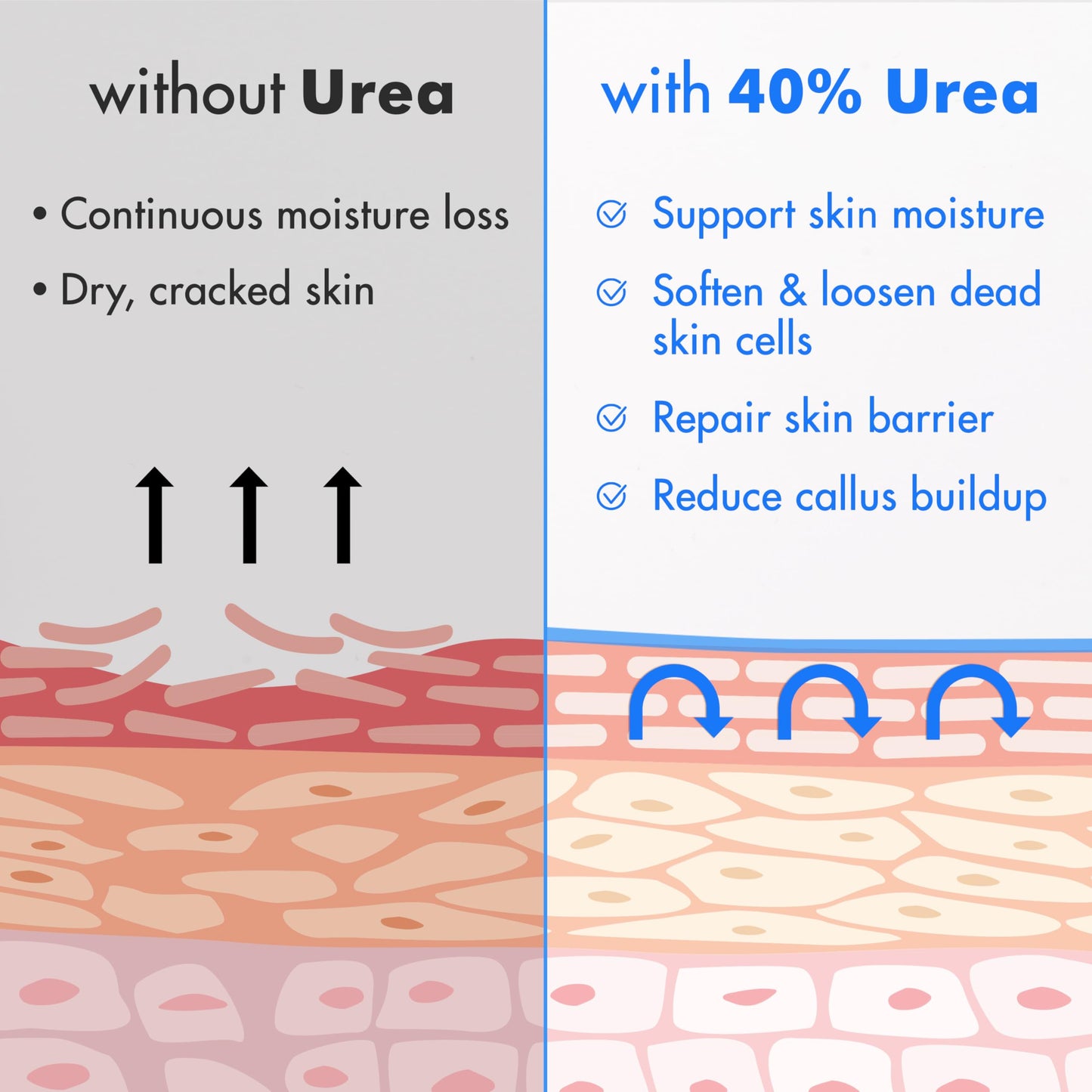 Ebanel Urea Cream 40% plus Salicylic Acid 2% for Dry Cracked Feet Skin, 2PK Beauty and Personal Care Ebanel