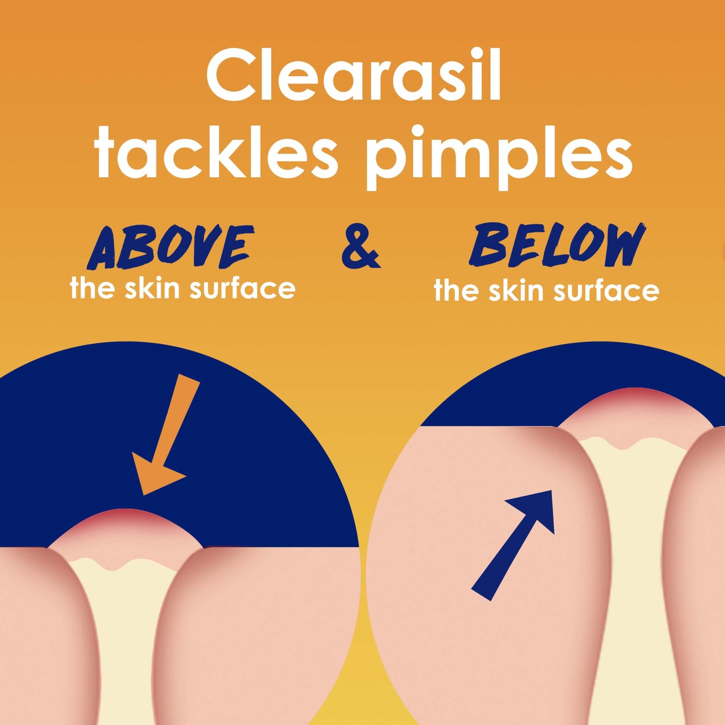 Clearasil Stubborn Acne Control 5in1 Exfoliating Wash, Maximum Strenght with 2% Salicylic Acid Acne Treatment Medicine, Daily Acne Facial Cleanser Beauty & Personal Care Clearasil