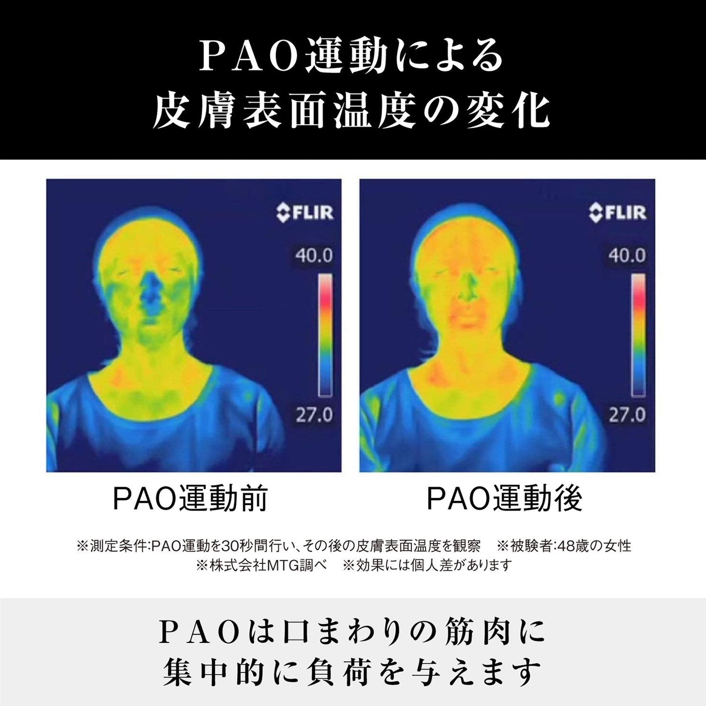MTG (Em Gee Tea) Facial Fitness PAO Pao Black Beauty & Personal Care MTG