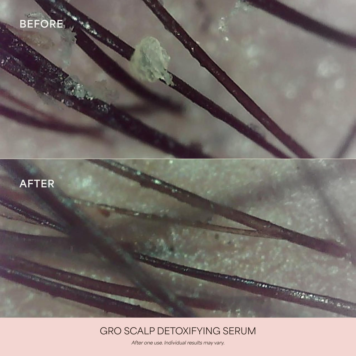 VEGAMOUR GRO Scalp Detoxifying Serum