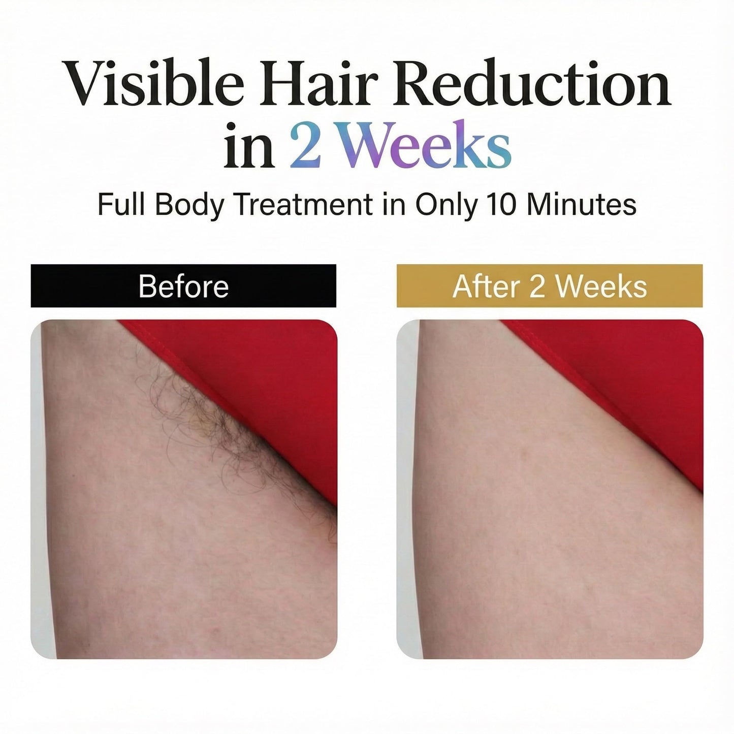 IPL Laser Hair Removal Device for Women & Men, Nex-Gen At Home Laser Hair Removal with 45°F Dual Sapphire Ice Cooling for Painless & Long Lasting Beauty and Personal Care EVO GLOW