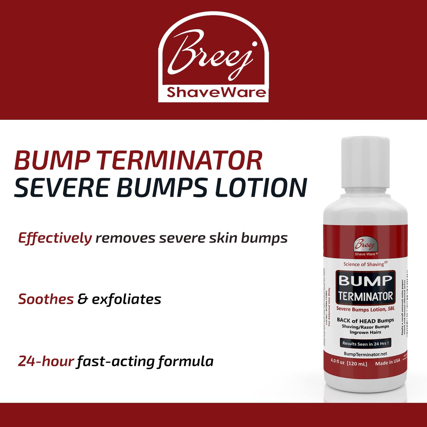 BREEJ Bump Terminator Severe Bumps Lotion (4oz) Beauty and Personal Care BREEJ