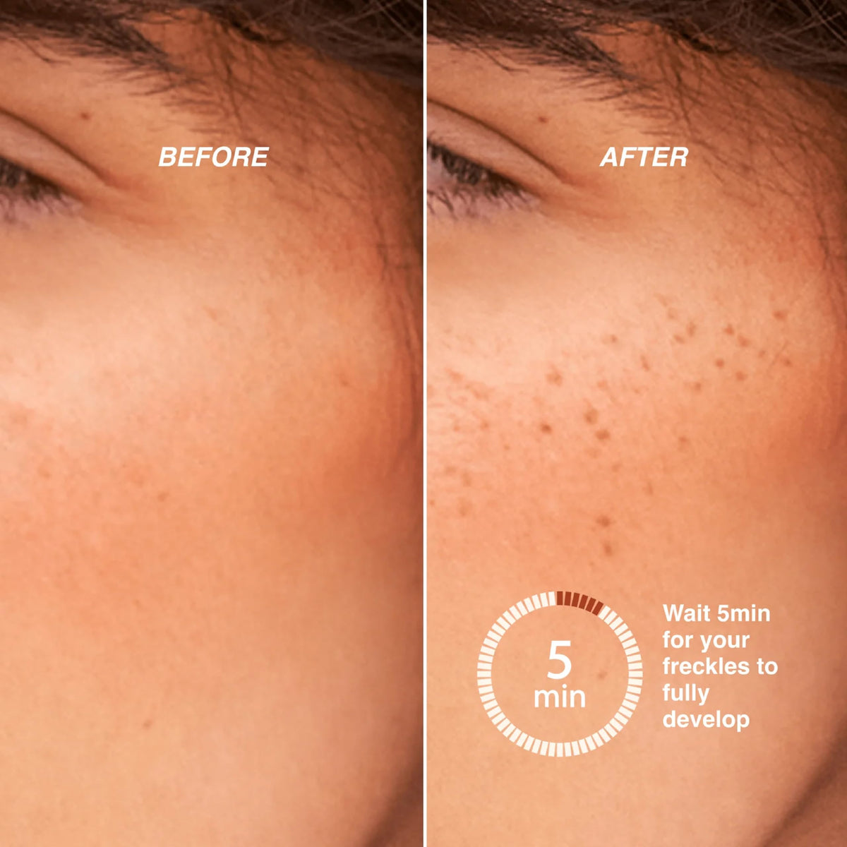 Freck XL Freckle Pen 3.15ml, Faux Freckles for Light to Medium Skin