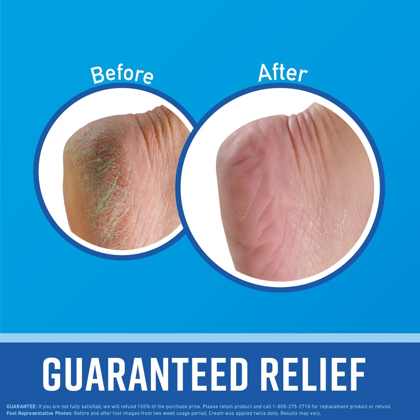 O'Keeffe's for Healthy Feet Foot Cream; Guaranteed Relief for Extremely Dry; Cracked Feet; Instantly Boosts Moisture Levels; 3.2 Ounce Jar; (Pack Beauty & Personal Care O'Keeffe's