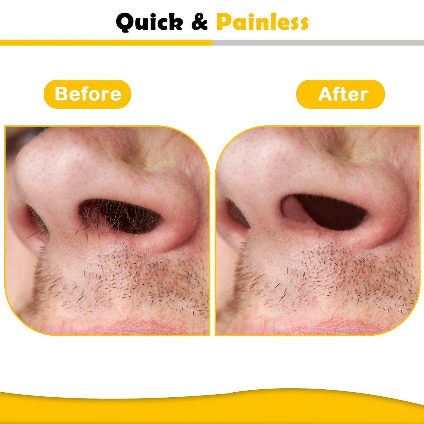 120g Wax Nose Wax Kit, Nose Hair Wax Kit with 40 Applicators, Quick & Painless Nose Waxing Kit for Men and Women, Nose Hair Remover Kits Used 20 Times Beauty and Personal Care Charmonic