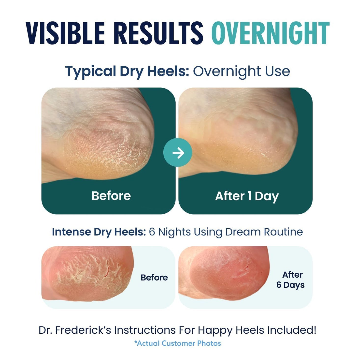 Dr. Frederick's Original Moisturizing Heel Socks for Dry Cracked Heels Treatment - Infused with Olive Oil, Jojoba Oil and Vitamin E - 2 Pairs - Self Beauty and Personal Care Dr. Frederick's Original