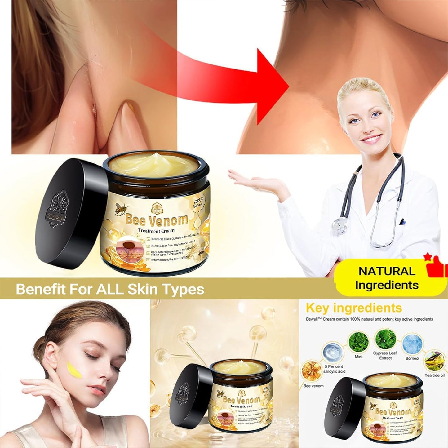 Bee Venom Skin Treatment Cream, 2024 New Bee Venom Repair Cream, Professional Bee Venom Cream-30g, Repair Maximum Strength for All Skin Types (1 Beauty & Personal Care AEEHFENG