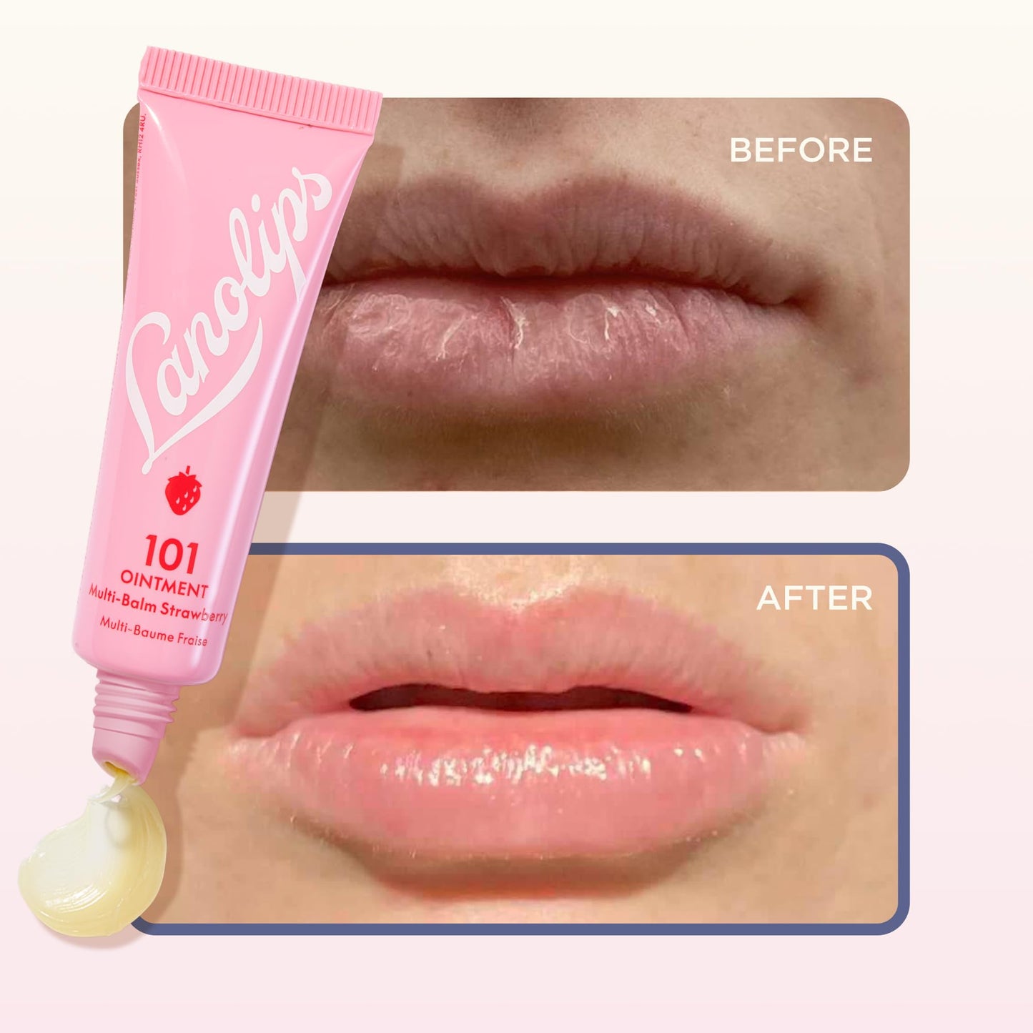 Lanolin 101 Multipurpose Ointment - Lanolin Lip Balm & Healing Ointment for Skin Barrier Repair - Moisturizer for Dry Lips, Cuticles & Elbows - No Beauty and Personal Care Lanolips
