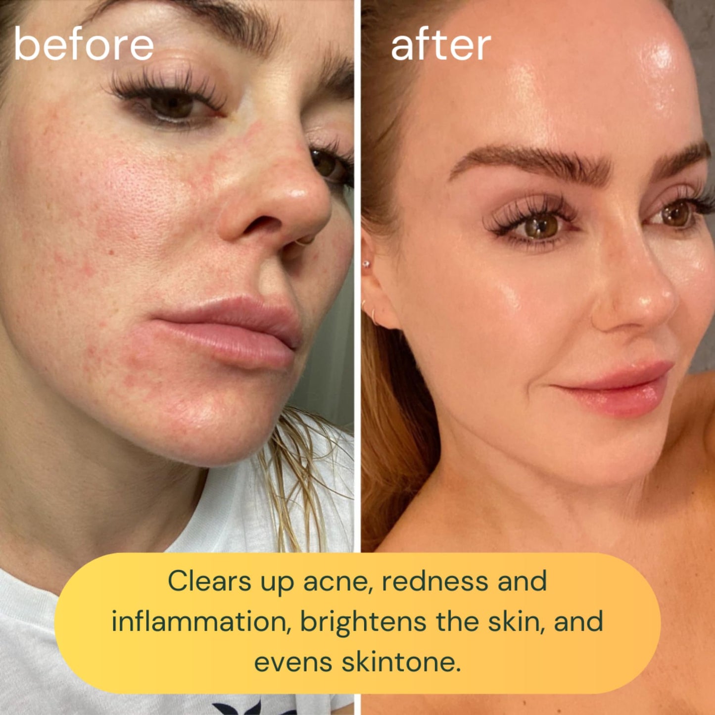 KOA LIFE Vit-C Illuminating Facial Cleanser - Vitamin C Facial Wash, Skin Illuminating Face Wash, Gentle Foam Cleanser, Vegan - 1.7 Fl Oz Beauty & Personal Care KOA LIFE