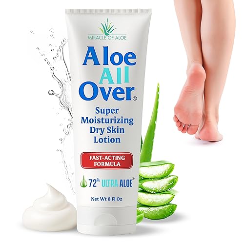Miracle of Aloe Aloe All Over Super Moisturizing Dry Skin Lotion 8 oz - Made with 72% UltraAloe Aloe Vera Gel. Safe for Everyone: Men, Women Beauty & Personal Care Miracle of Aloe