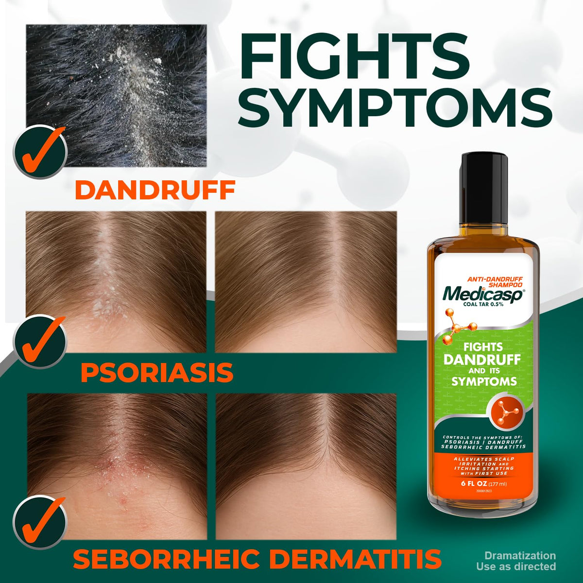 Medicasp Coal Tar Anti-Dandruff Shampoo, Flakes Shampoo, 6 fl oz