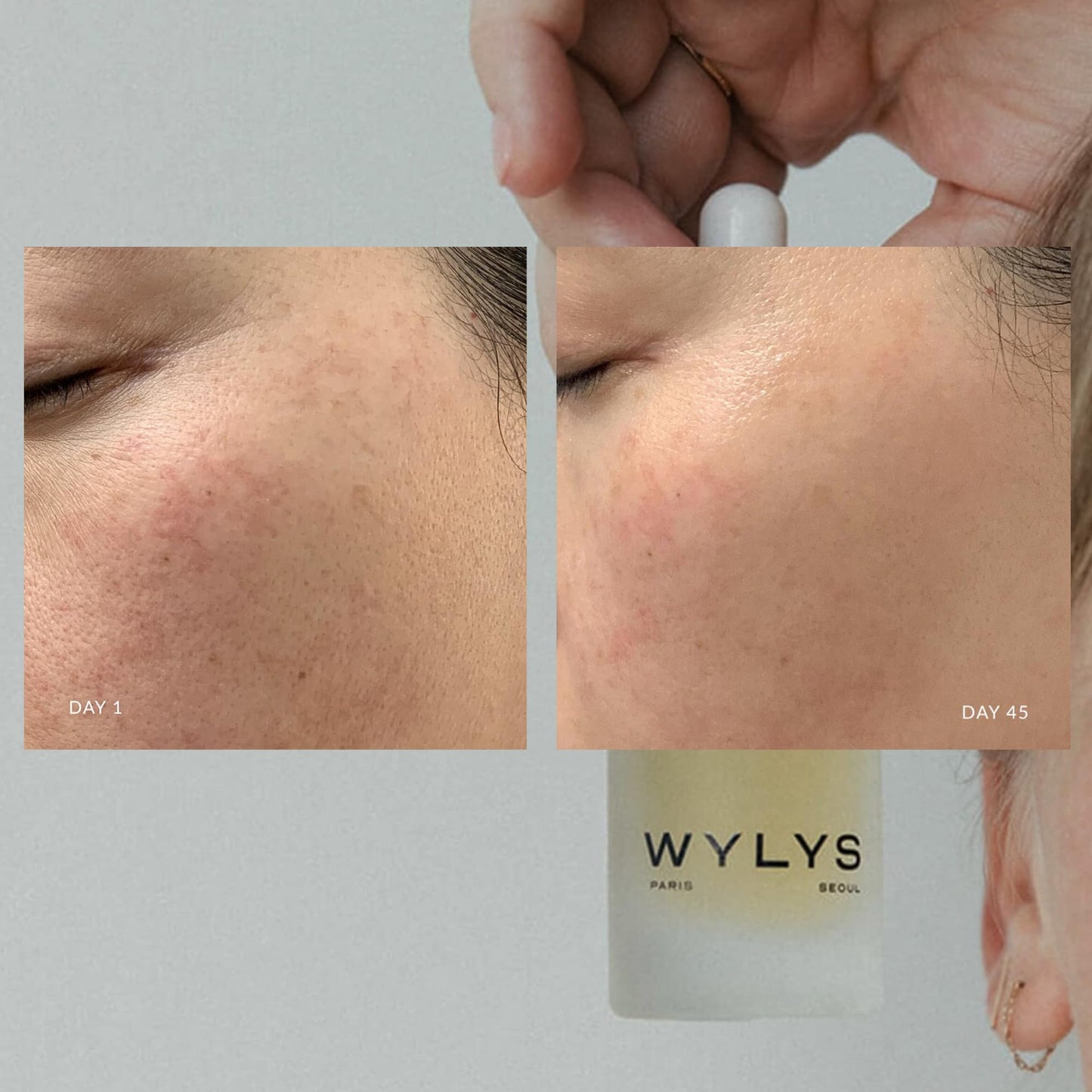 Liquid V-Lift - Peptide Face Serum for Aging Skin | Lifts, Firms & Brightens with Collagen & AFA-GS Alga | Reduces Wrinkles & Fine Lines | Lightweight Beauty & Personal Care WYLYS
