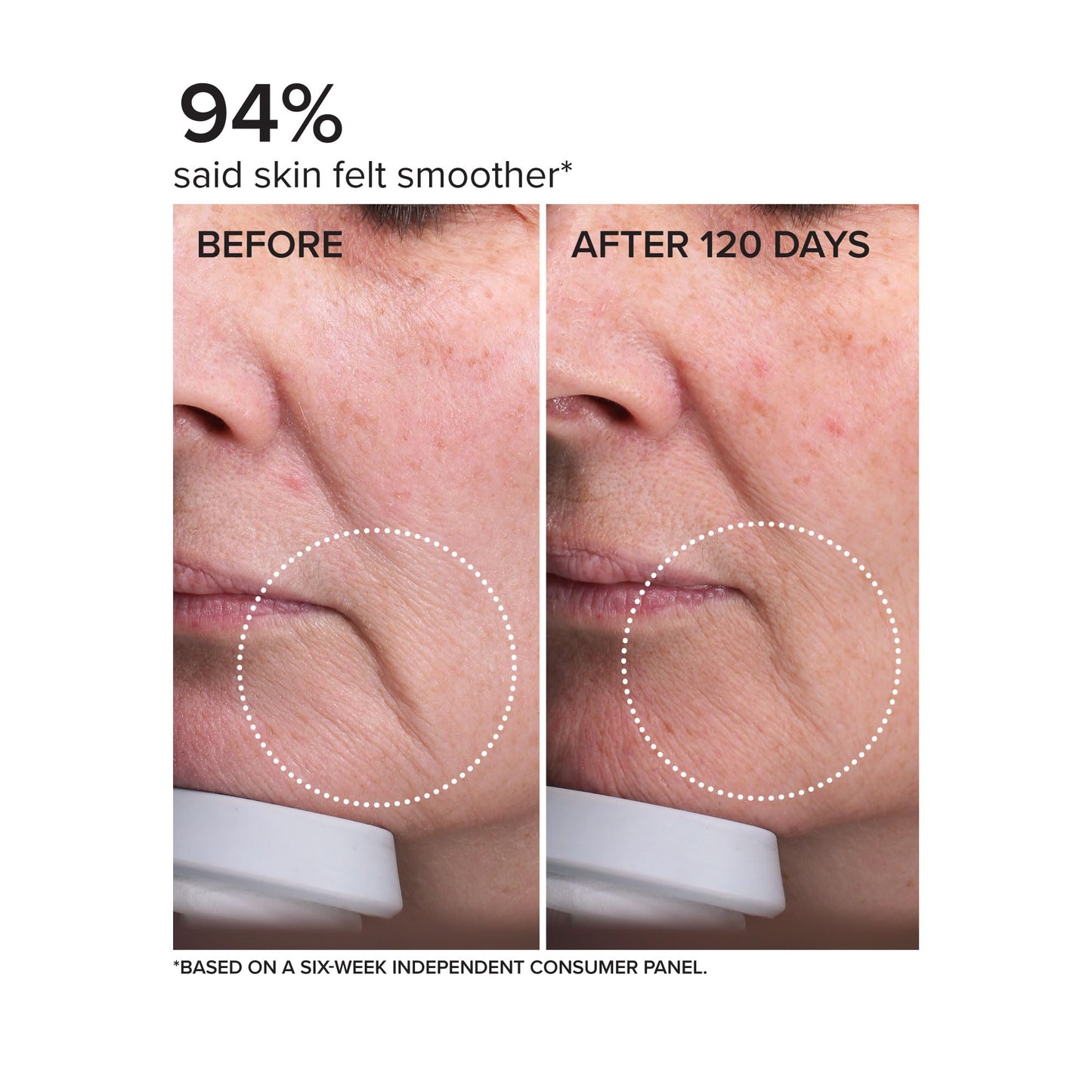 DRMTLGY Needle-less Serum - Peptide & Ceramide Face Serum for Fine Lines & Wrinkles, Hydrating & Firming Anti Aging Serum with Niacinamide Beauty & Personal Care DRMTLGY