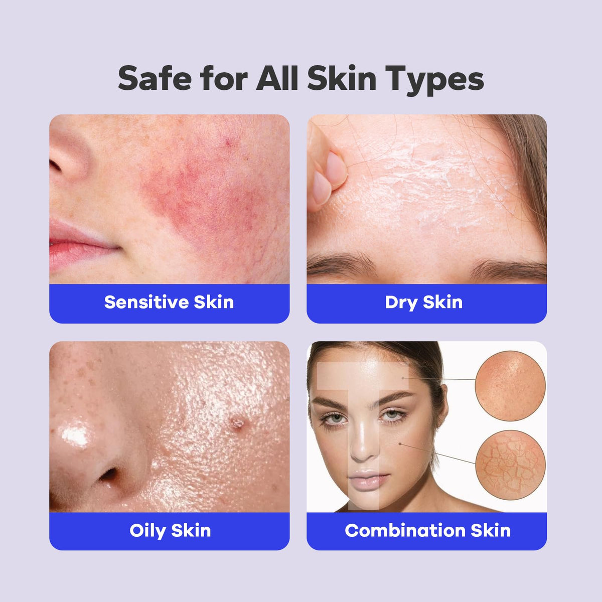 SilkyShark 2% Salicylic Acid Body Spray (5.07 Fl Oz), Back Acne Treatment Spray for Chest, Shoulders & Face, Body Acne Spray for Blackheads Beauty & Personal Care SilkyShark