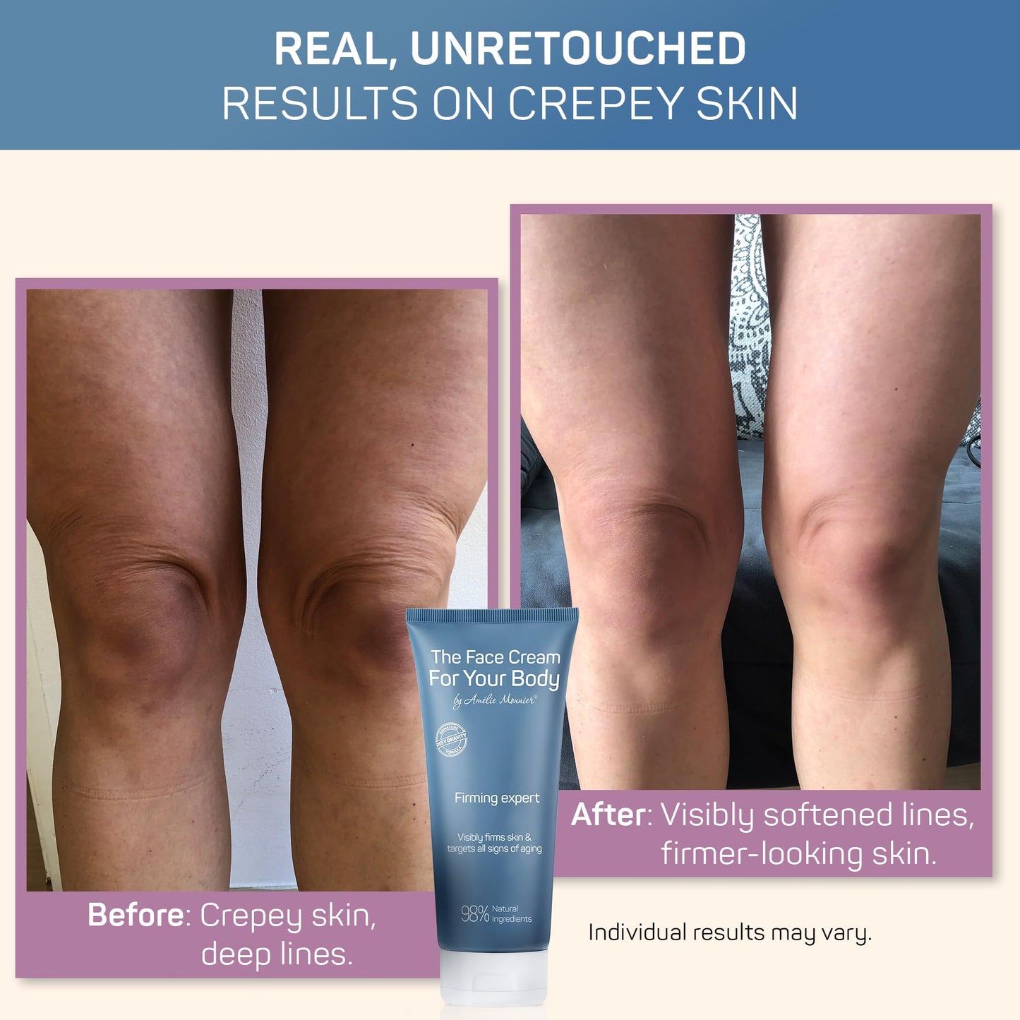 Crepe Firming Advanced Cream - European Hi-tech Skin care - Hyaluronic Acid in the 50-3000 kDa Molecular Spectrum - Tightening & Lifting Collagen Beauty & Personal Care Amélie Monnier