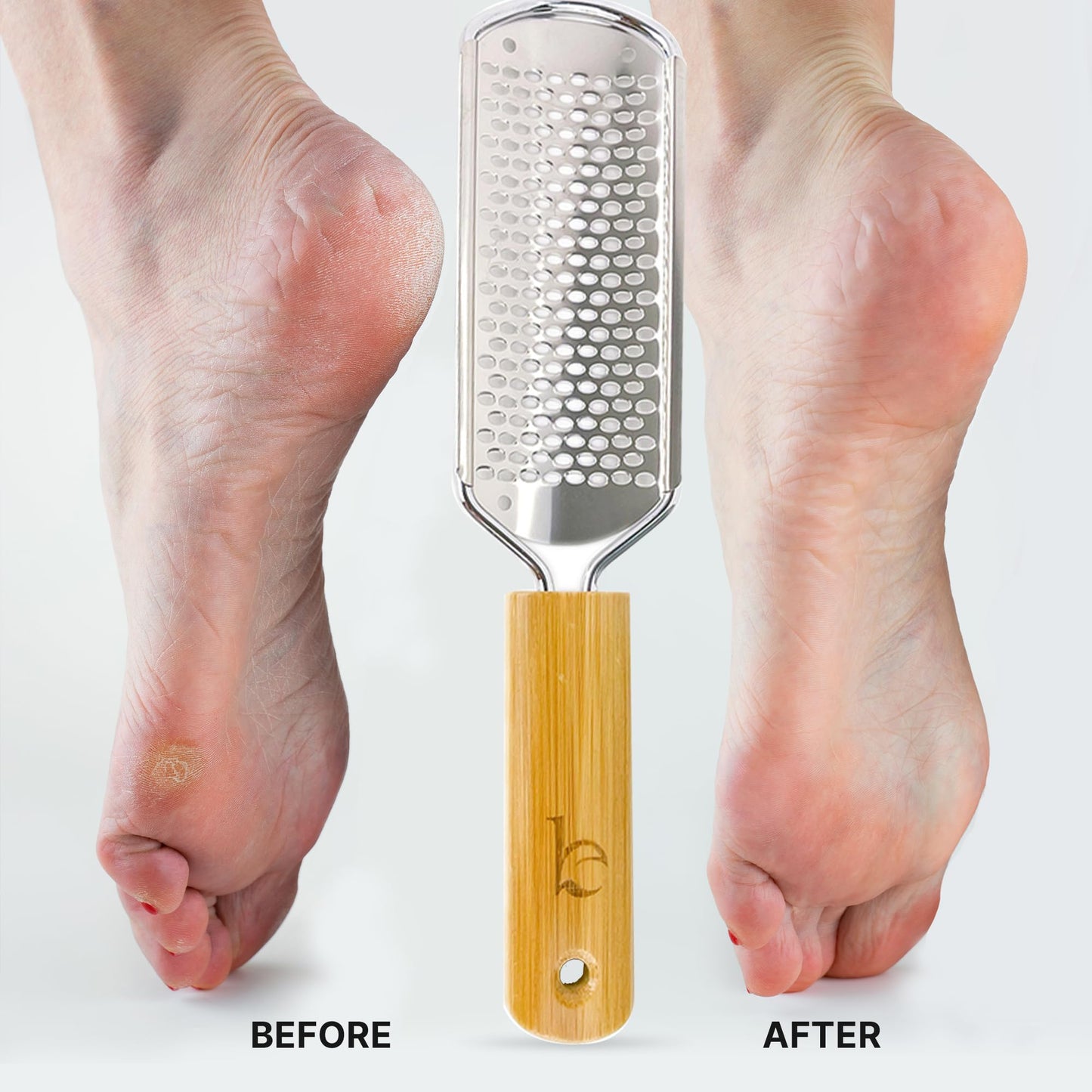 Foot File - Callus Remover Tool for Dead Skin Removal, at Home Pedicure Tools, Foot Rasp Callus Remover Feet and Heels, Smooth Soft Feet Using a Beauty & Personal Care Beauty by Earth