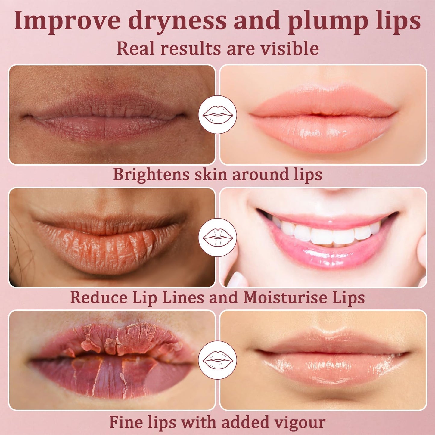 Lip Mask 30PCS Collagen Lip Masks Overnight: Hydrating Moisturizing Lip Mask Sheet Pack Bulk with Hydrogel Crystal Gold Essence - Lip Sleeping Mask Beauty and Personal Care RAINFLOW