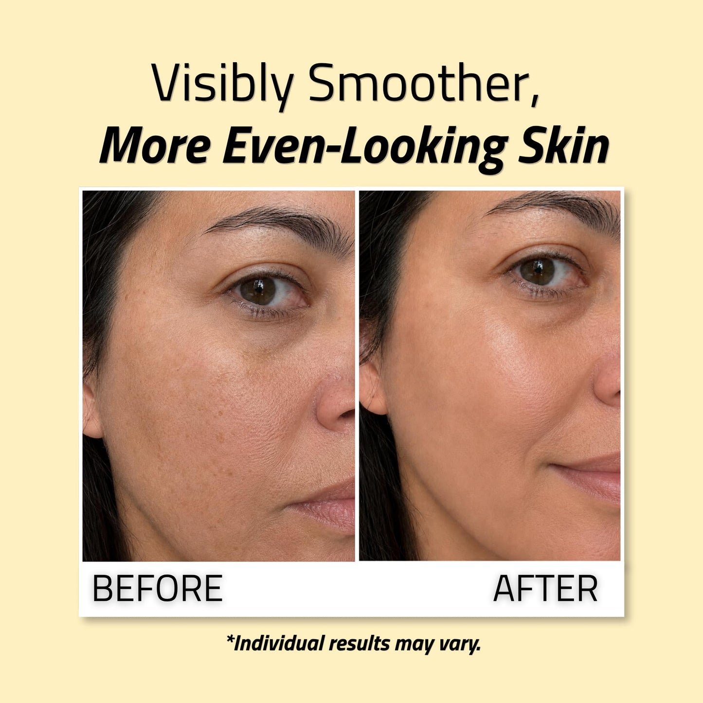 YEOUTH Niacinamide Serum with Hyaluronic Acid and Licorice Root, 1oz Beauty & Personal Care YEOUTH