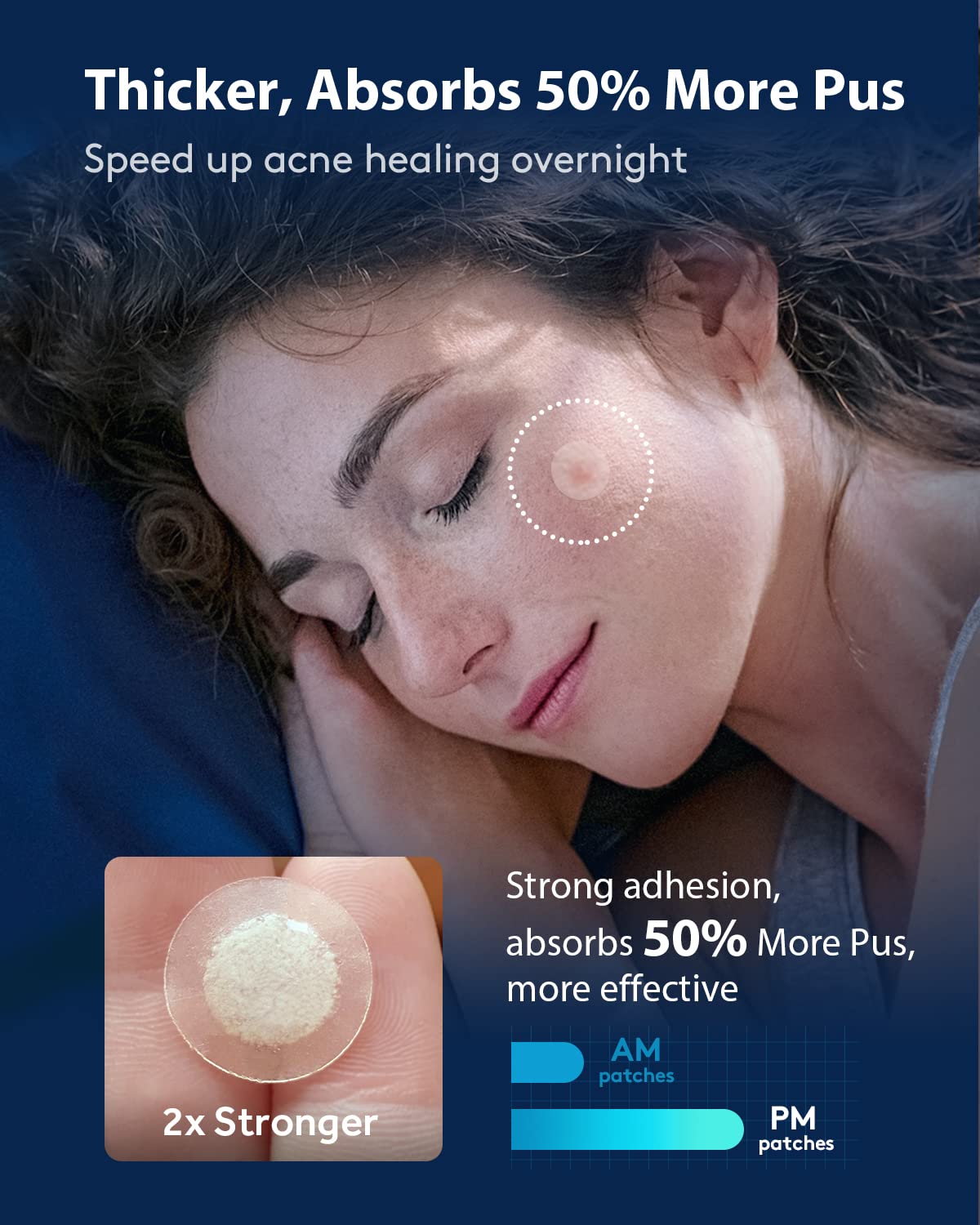 LitBear Acne Pimple Patches- Day and Night 4 Sizes 360 Dots Thin & Thick Hydrocolloid Patches with Witch Hazel, Tea Tree & Calendula Oil, Extra Beauty and Personal Care LitBear