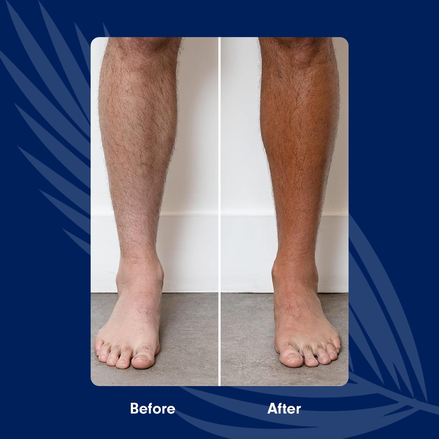 Toma's Total Tan Mousse Instant Sunless Tanner - Whole Body Self-Tanning for Women & Men, Natural Looking Golden Bronze Color Streak-Free Application Beauty & Personal Care TOMAS TOTAL TAN