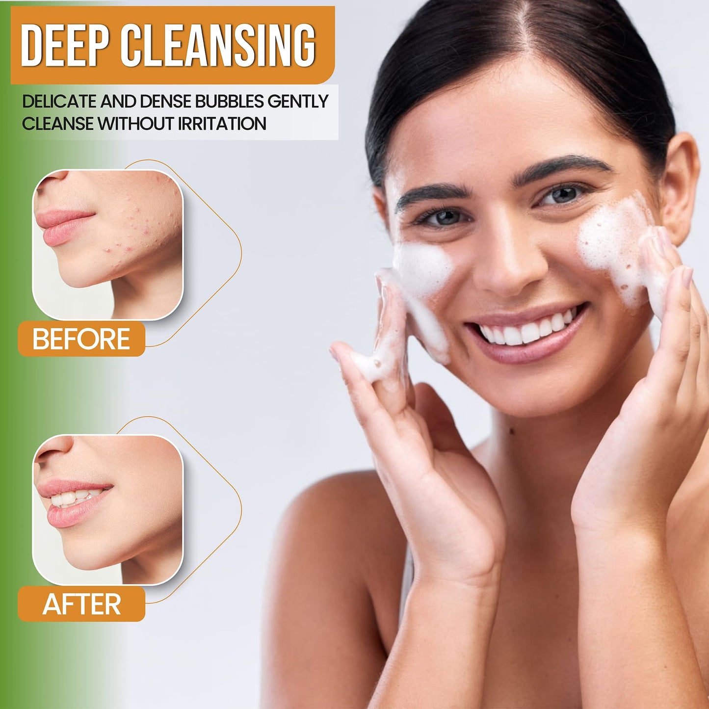 Turmeric Face Wash - Turmeric Facial-Cleanser with Aloe Vera, Vitamin E, and Natural Extracts - Lightweight Daily Gel Face Wash for All Skin Types Beauty & Personal Care AMVital