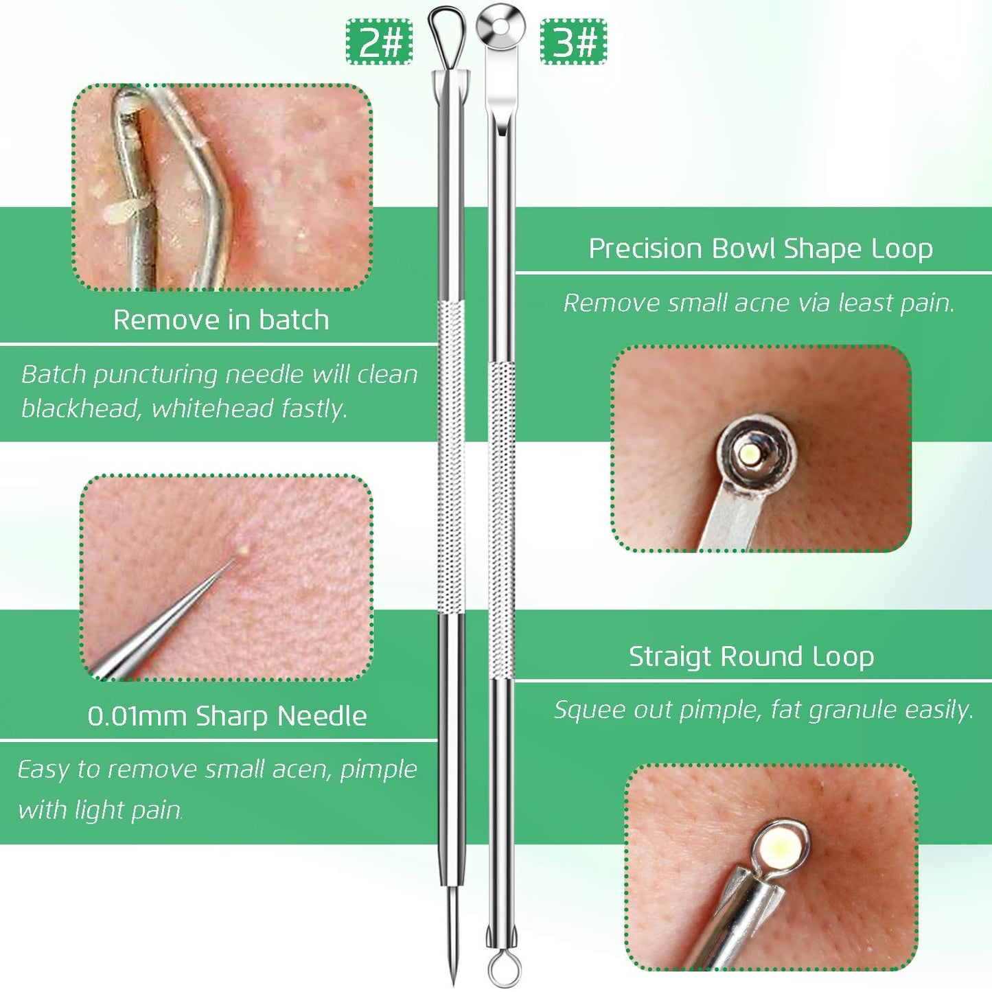 5PCS Blackhead Remover Comedone Extractor, Curved Blackhead Tweezers Kit, Professional Stainless Pimple Acne Blemish Removal Tools Kit for Manual Beauty & Personal Care UWOIST