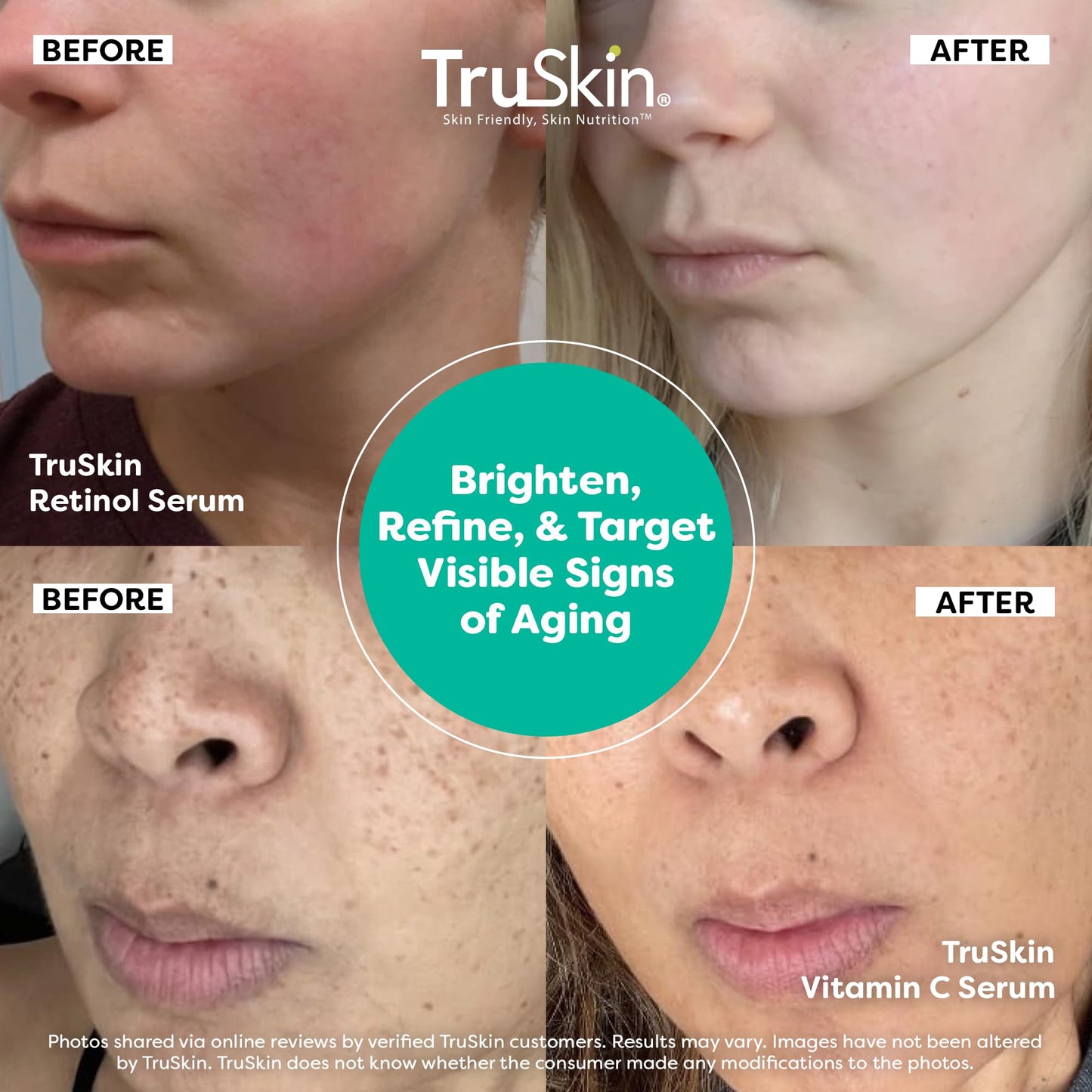 TruSkin Face Serum Duo - Vitamin C Serum & Retinol Serum for Face - AM & PM Anti Aging Skincare Routine - Brightening & Smoothing Facial Serums, 1 fl Beauty & Personal Care TruSkin